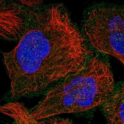 INTS11 Antibody, Novus Biologicals:Antibodies:Primary Antibodies